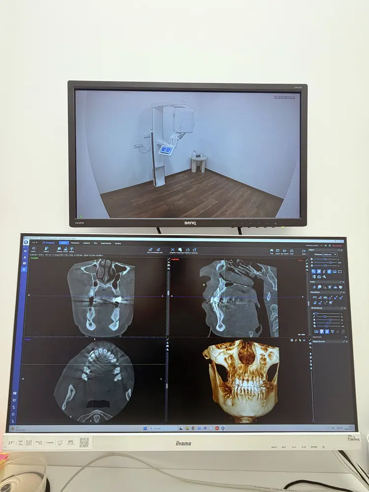 3D образ на мониторите