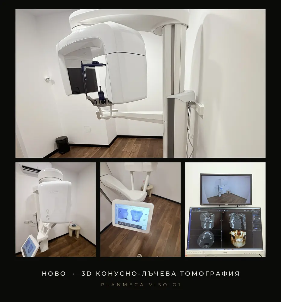 3D конусно-лъчева томография